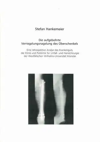 Die aufgebohrte Verriegelungsnagelung des Oberschenkels. Eine retrospektive Analyse des Krankenguts der Klinik und Poliklinik für Unfall und Handchirurgie der Westfälischen Wilhelms-Universität Münster (Dissertationsschrift). 