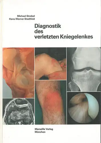 Diagnostik des verletzten Kniegelenkes. 