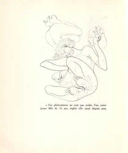 Bellmer, Hans: Petite anatomie de l'inconscient physique ou l'anatomie de l'image. 