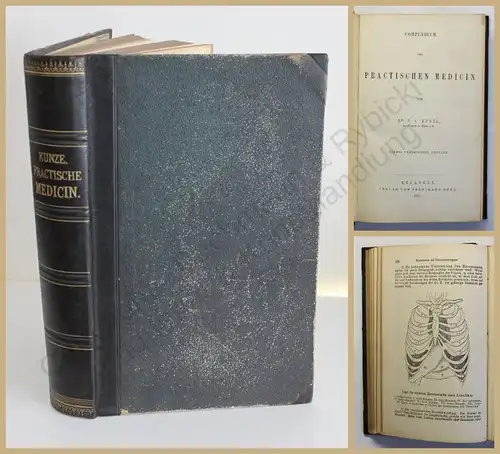 Kunze Compendium der Practischen Medicin 1871 4. Auflage Medizin Wissen xy