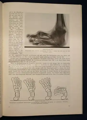 Marquardt Die theoretischen Grundlagen der Orthopädie-Schuhmacherei 1951 sf