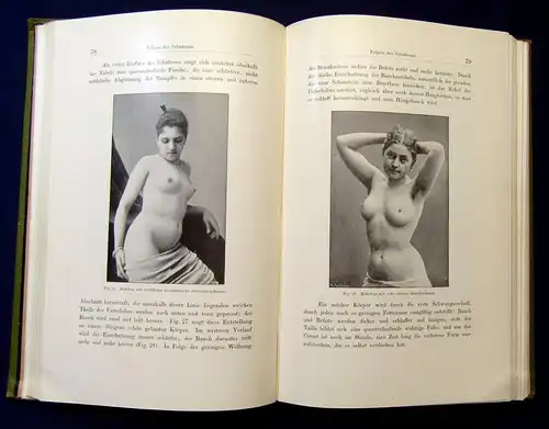 Stratz Die Schönheit des weiblichen Körpers 1900 128 Abb, 3von4 Tafeln mb