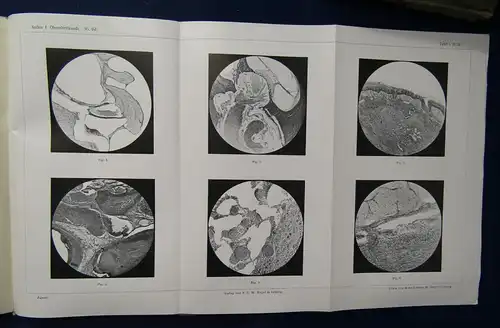 Politzer/Schwartze Archiv für Ohrenheilkunde 58 Bände um 1900 Medizin Wissen sf