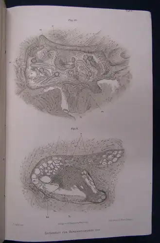 Knapp/ Moos Zeitschrift für Ohrenheilkunde 17.& 18. Band 1887 Medizin Wissen sf