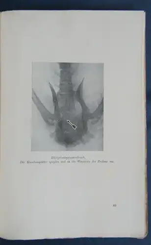 Weiler Tierärztliche Röntgenkunde 74 Abbildungen 1923 Naturwissenschaften  js