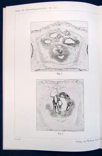 Fischel Über das Differenzierungsvermögen der Gehirnzellen 2 Tafeln 1914  js