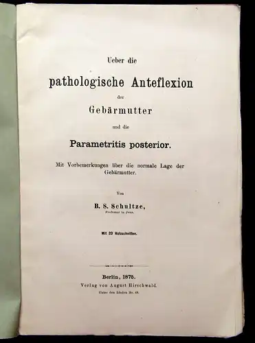 Schultze Über die pathologische Anteflexion der Gebärmutter 1875 Medizin mb