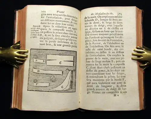 Petit 1741 Traité des maladies des os, dans lequel on a représenté les Appareils