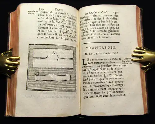 Petit 1741 Traité des maladies des os, dans lequel on a représenté les Appareils