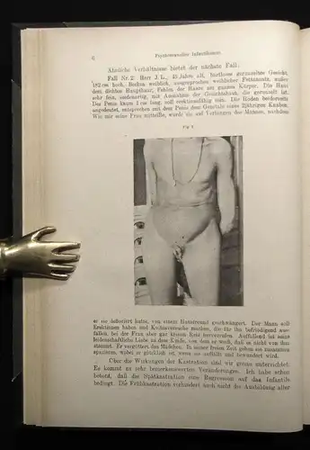 Psychosexueller Infantilismus (Seelische Kinderkrankheiten der Erwachsenen) 1922