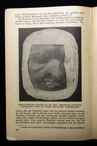 Dr. Galewsky Ausstellung Die Geschlechtskrankheiten und ihre Bekämpfung 1921