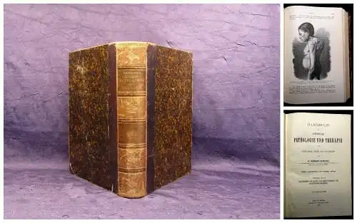 Eichhorst Handbuch der speciellen Pathologie und Therapie 4. Bd. apart 1897