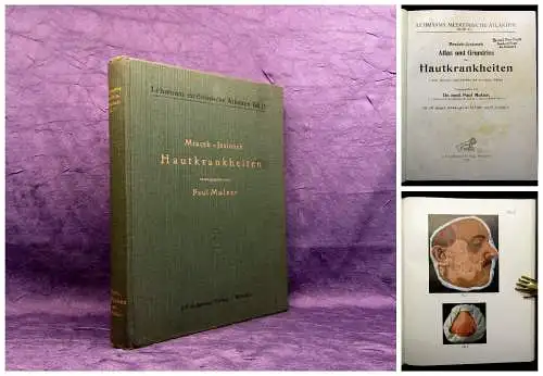 Mulzer Lehmanns medizinische Atlanten Bd.15 Mracek-Jesionek Hautkrankheiten 1924