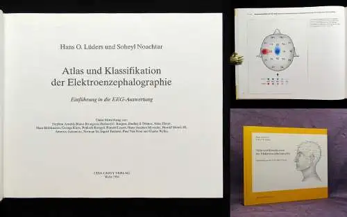 Lüders, Noachtar Atlas und Klassifikation der Elektroenzephalographie 1994