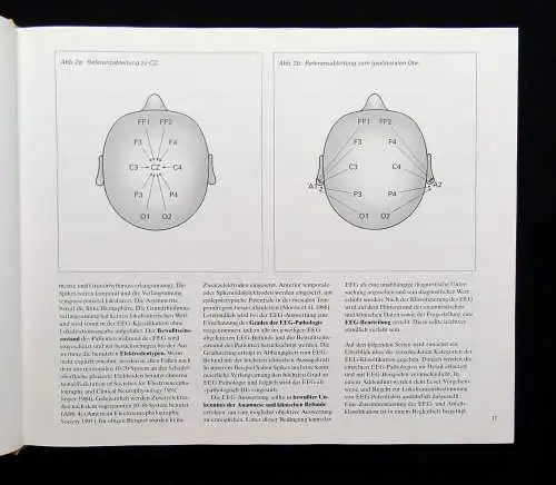 Lüders, Noachtar Atlas und Klassifikation der Elektroenzephalographie 1994