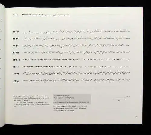 Lüders, Noachtar Atlas und Klassifikation der Elektroenzephalographie 1994