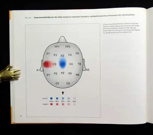 Lüders, Noachtar Atlas und Klassifikation der Elektroenzephalographie 1994