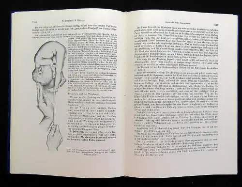 Kraatz Stoeckels Lehrbuch der Geburtshilfe 3 Bde. 1966/67 Biologie Vermehrung