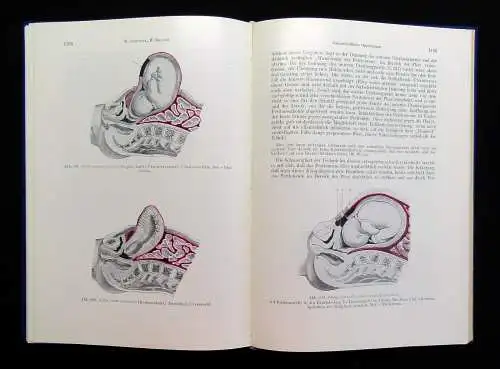 Kraatz Stoeckels Lehrbuch der Geburtshilfe 3 Bde. 1966/67 Biologie Vermehrung