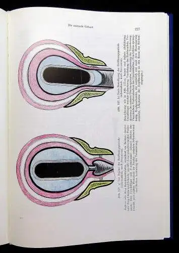 Kraatz Stoeckels Lehrbuch der Geburtshilfe 3 Bde. 1966/67 Biologie Vermehrung