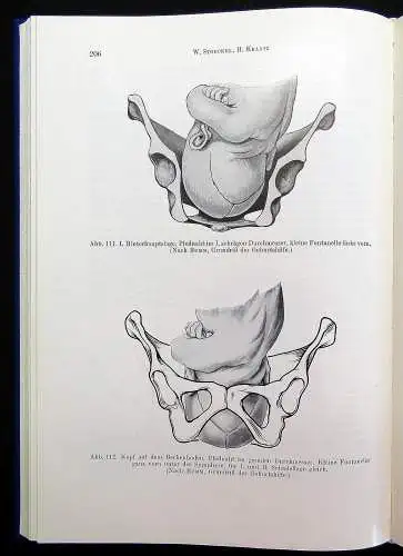 Kraatz Stoeckels Lehrbuch der Geburtshilfe 3 Bde. 1966/67 Biologie Vermehrung