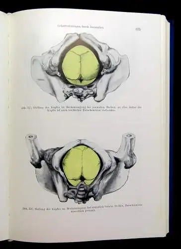 Kraatz Stoeckels Lehrbuch der Geburtshilfe 3 Bde. 1966/67 Biologie Vermehrung