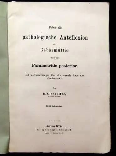 Schultze Über die pathologische Anteflexion der Gebärmutter 1875 Medizin mb