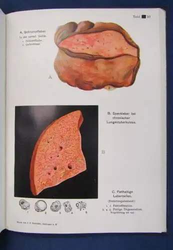 Müller Der Weg zur Gesundheit 1.Bd 1930 selten Vetreterexemplar Beilage js