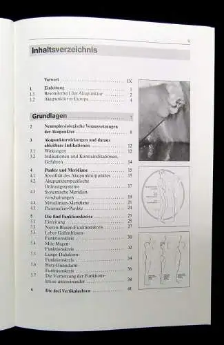 Gleditsch Akupunktur in der Hals-Nasen-Ohrenheilkunde 1997 41 Abbildungen