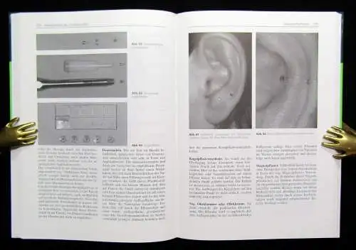 Rubach Propädeutik der Ohr- Akupunktur Mikrosystem der Ohrmuschel 1995 Anatomie