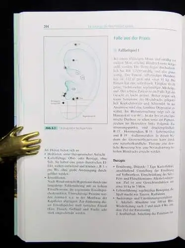 Therapiehandbuch Akupunktur, Therapiehandbuch Naturheilkunde 1997,99 Heilung