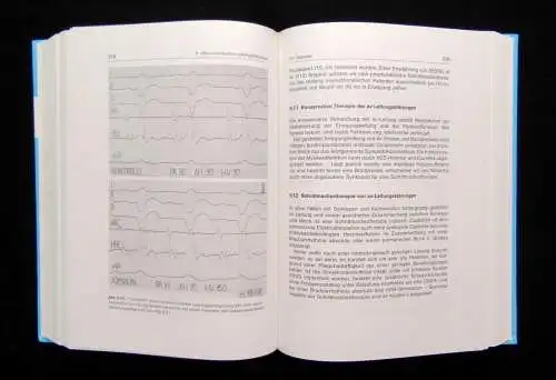 Rostock Herzrhytmusstörungen in Theorie und Praxis 1993 202 Abbildungen