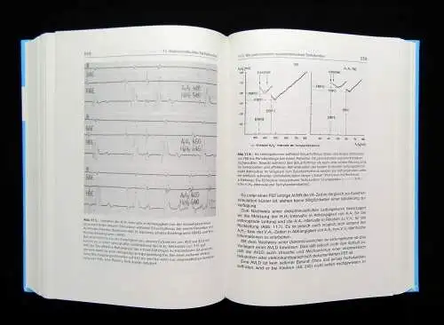 Rostock Herzrhytmusstörungen in Theorie und Praxis 1993 202 Abbildungen