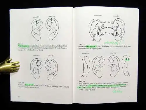 Bahr Akupunktur in der täglichen Praxis Bereich Ohr,Körper,Schädelakupunk. 1989