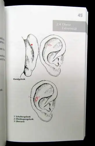 Strittmatter Taschenatlas Akupunktur nach Nogier/ Bahr 2001 Schmerzpunkte