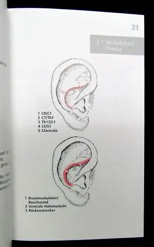 Strittmatter Taschenatlas Akupunktur nach Nogier/ Bahr 2001 Schmerzpunkte