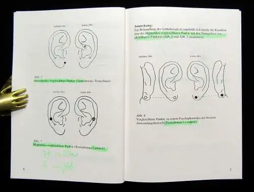 Bahr Akupunktur in der täglichen Praxis Bereich Ohr,Körper,Schädelakupunk. 1989