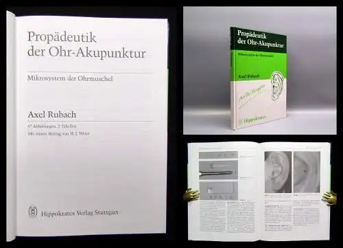 Rubach Propädeutik der Ohr- Akupunktur Mikrosystem der Ohrmuschel 1995 Anatomie