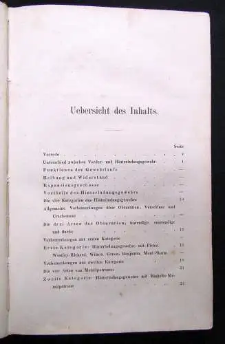 Neumann Das Wesen der Hinterladungs-Gewehre. Übersichtliche und allgemein 1867