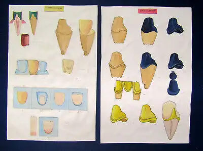 Sammlung 5 Zeichnungen von Zahn - Kronen um 1970 Zahnheilkunde Technik sf