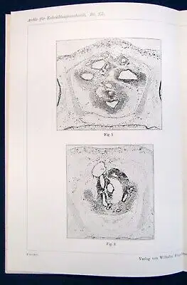 Fischel Über das Differenzierungsvermögen der Gehirnzellen 2 Tafeln 1914  js