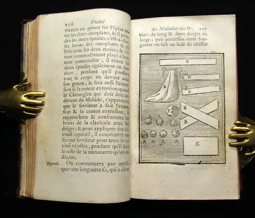 Petit 1741 Traité des maladies des os, dans lequel on a représenté les Appareils