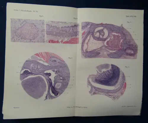 Politzer/Schwartze Archiv für Ohrenheilkunde 58 Bände um 1900 Medizin Wissen sf