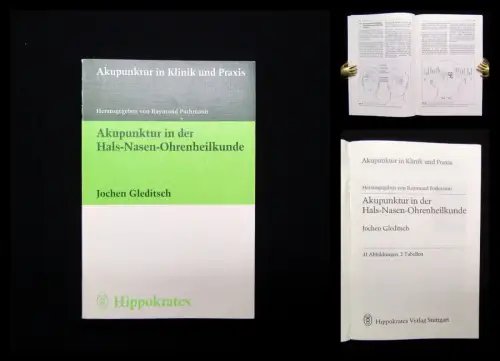 Gleditsch Akupunktur in der Hals-Nasen-Ohrenheilkunde 1997 41 Abbildungen