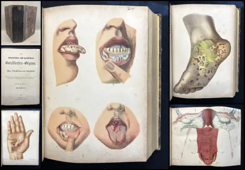 Gleisberg Die männlichen und weiblichen Geschlechtsorgane 2 Bde. in 1 1886 Abb.