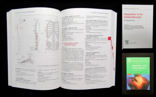 Bäcker, Hammes Akupunktur in der Schmerztherapie 2005 Leitlinien Leitfaden