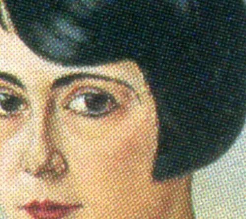 1748 Schad mit PLF Bruch der rechten Augenbraue, Feld 9, **