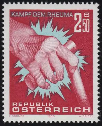 1632 Kampf dem Rheuma, Hand einer Rheumakranken, 2.50 S, postfrisch **