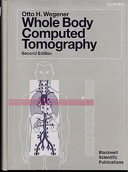 Whole Body Computed Tomography. Wegener, Otto