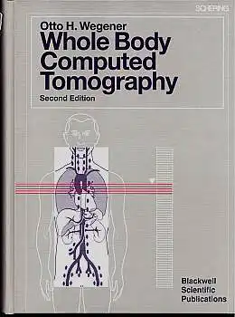 Wegener, Otto: Whole Body Computed Tomography. 